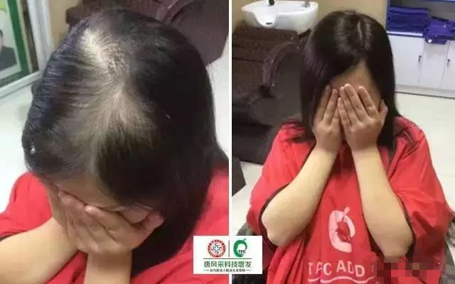呼和浩特賣假發(fā) 客戶案例