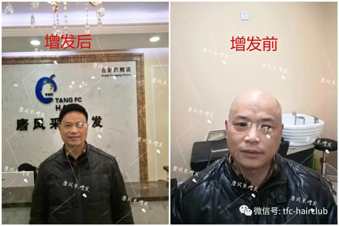 天津定做男士假發(fā) 客戶案例
