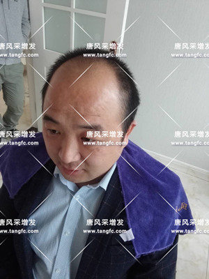 上海真人發假發地址 客戶案例