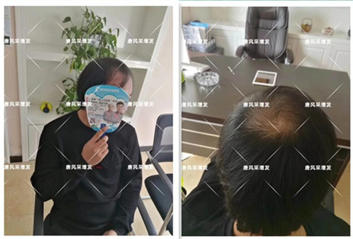 唐山賣(mài)假發(fā)套 假發(fā)案例客戶