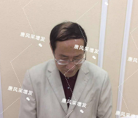 長春賣假發 假發