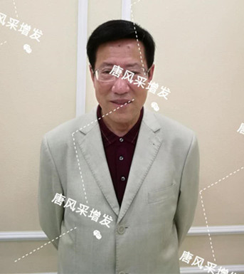 長春賣假發 增發后