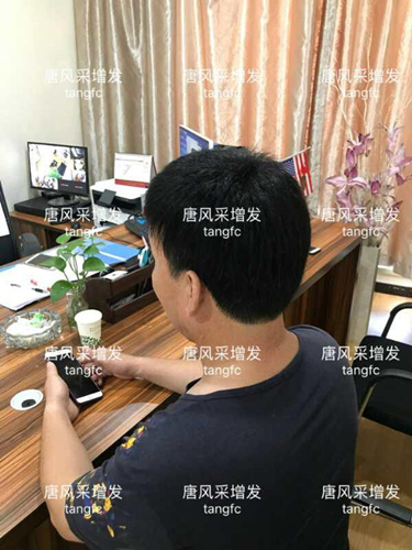 中年禿頂危機 增發后