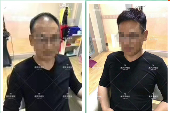 中老年假發(fā)短發(fā)品牌 王先生客戶案例