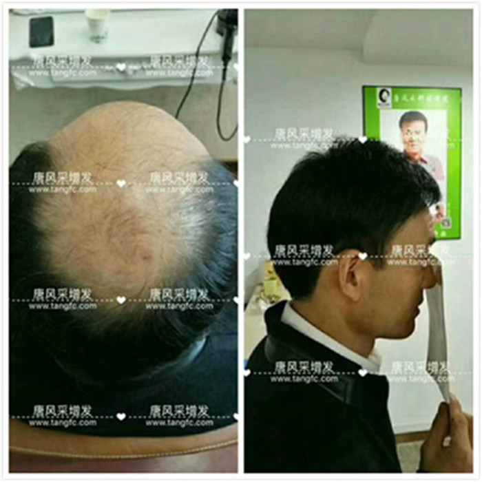 天津補發 客戶案例