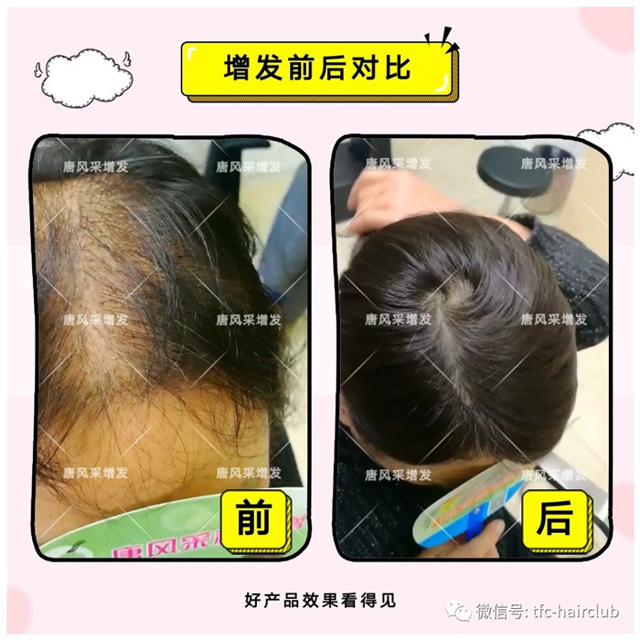 女性加密織發效果 唐風采增發
