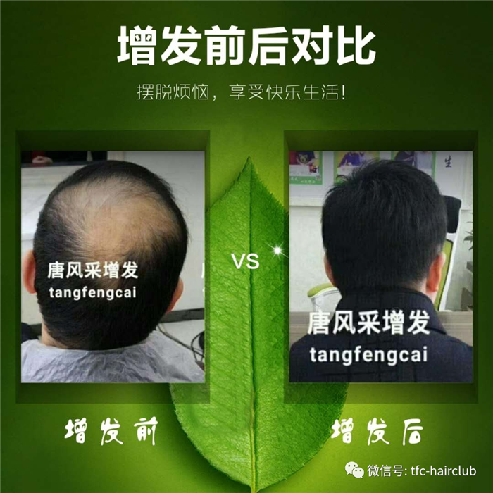 包頭哪里有真發(fā)假發(fā)套的專賣店 包頭哪里有真發(fā)假發(fā)套的專賣店?