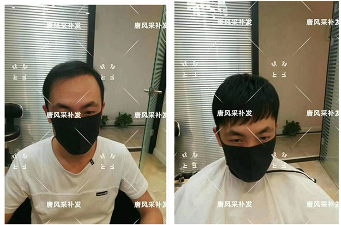 南昌哪里做真人假發的 南昌哪里做真人假發的?脫發還是定制的好
