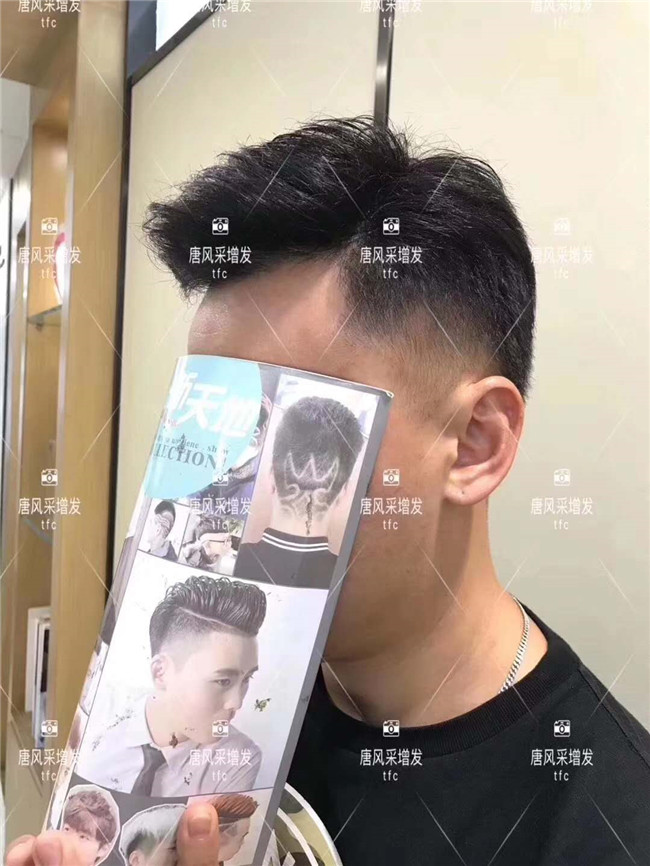 謝頂男人 在唐風采增發后