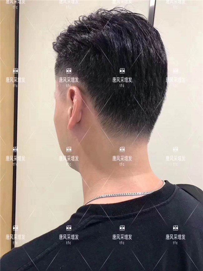謝頂男人 在唐風采增發后