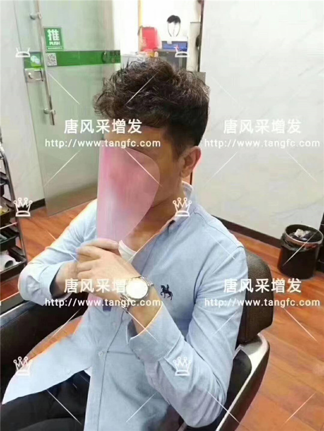 謝頂男人 卷發