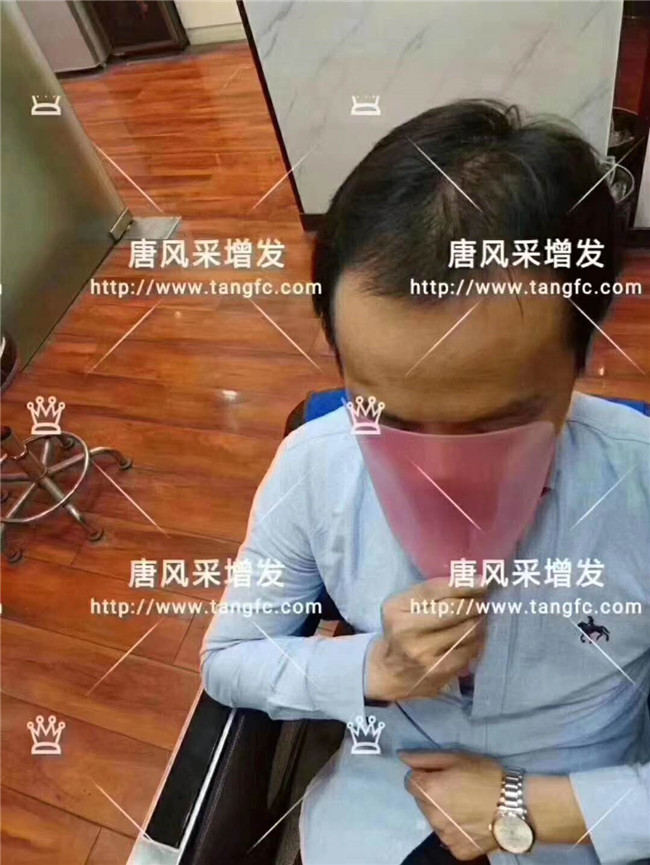 謝頂男人 卷發