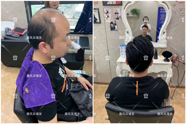 隱形假發