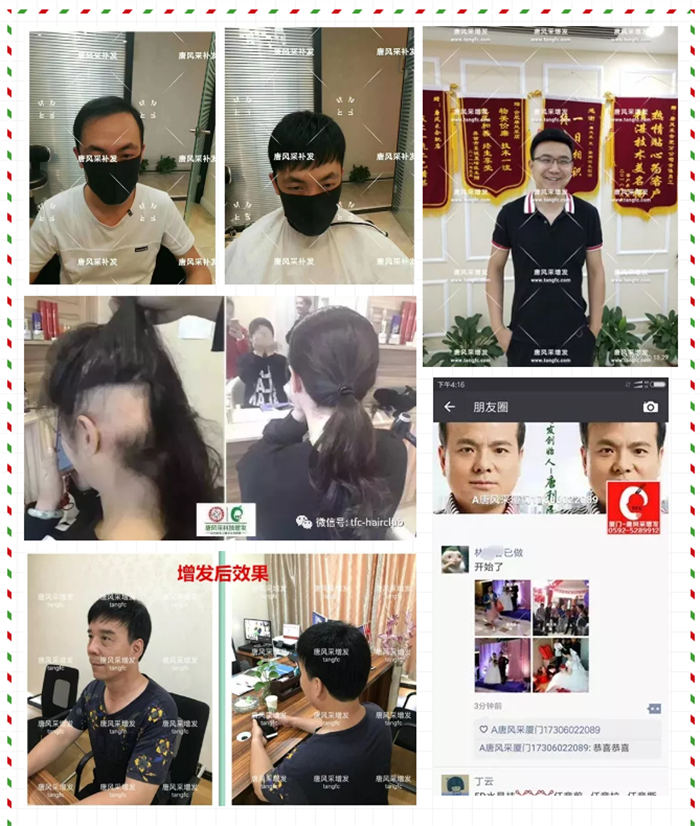 唐風采無痕補發技術 唐風采增發
