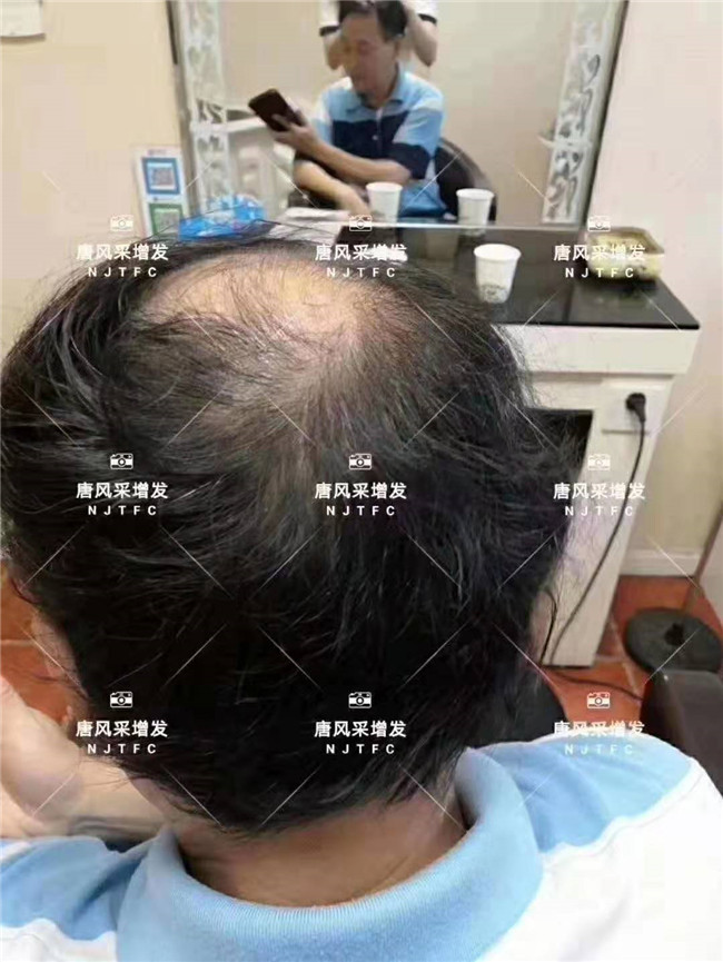 做增發 “地方支援中央”政策。
