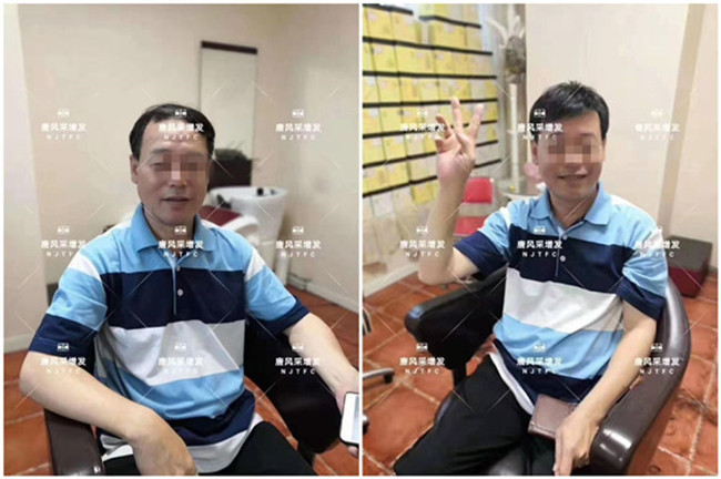 做增發 頭發變濃密了