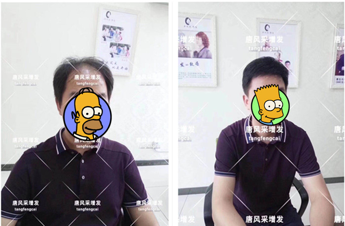男老師戴假發 無痕假發
