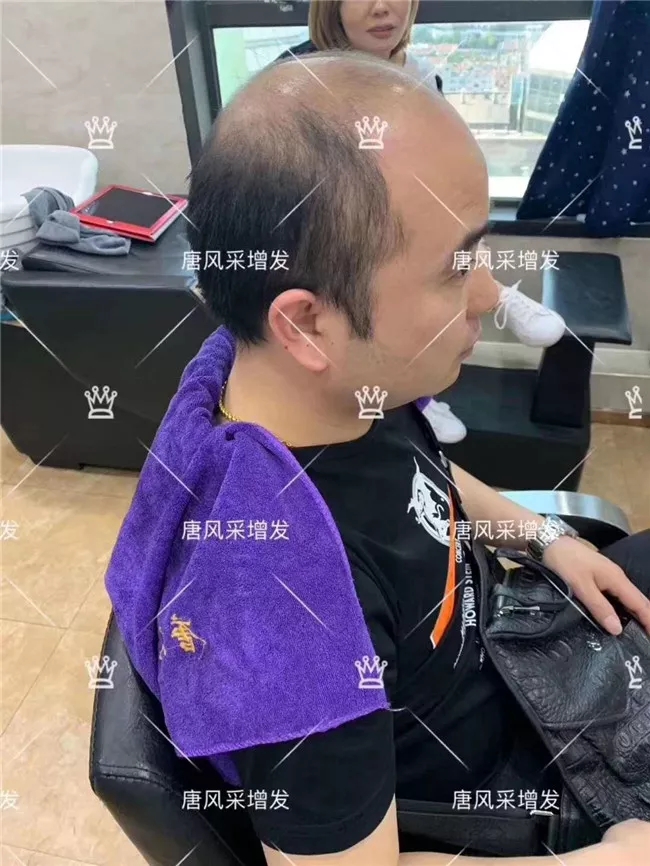半頭套假發、全頭假發、局部假發片 唐風采隱形增發