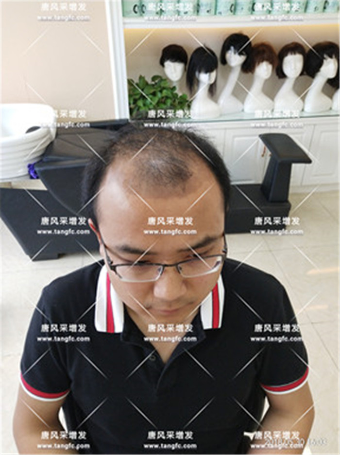 男生中分假發(fā)、短假發(fā)、假發(fā)頭套 唐風(fēng)采客戶案例