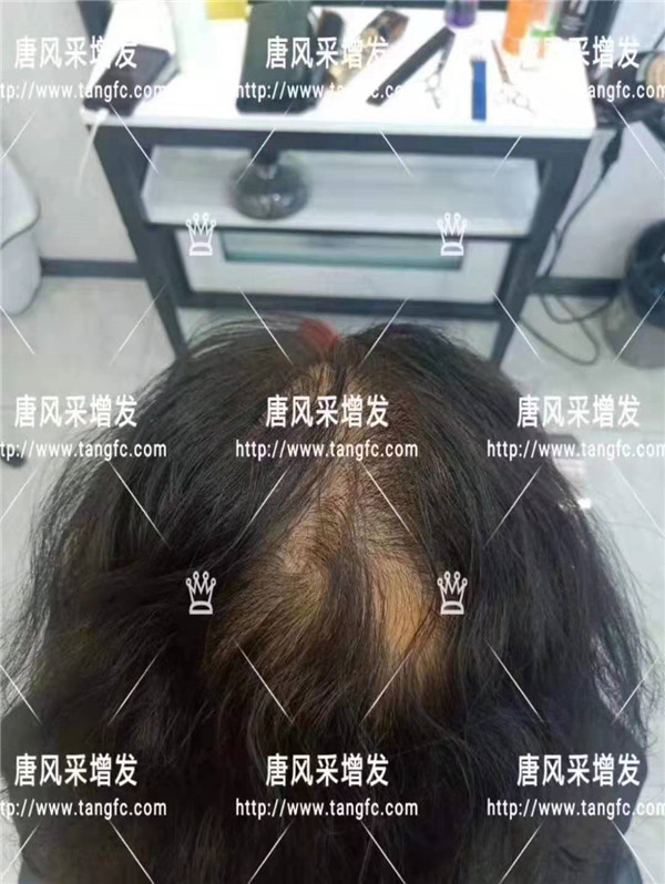 時尚假發 官方二維碼 唐風采無痕假發