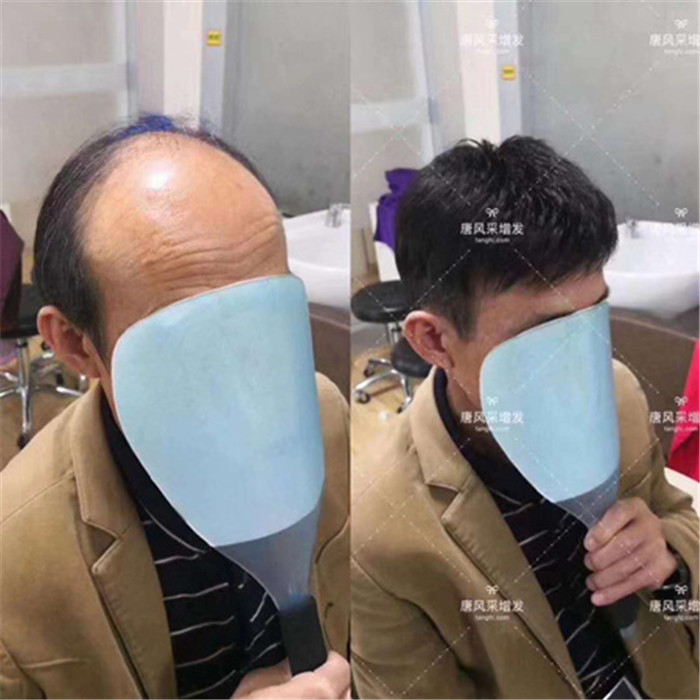 手鉤假發 唐風采客戶案例分享篇