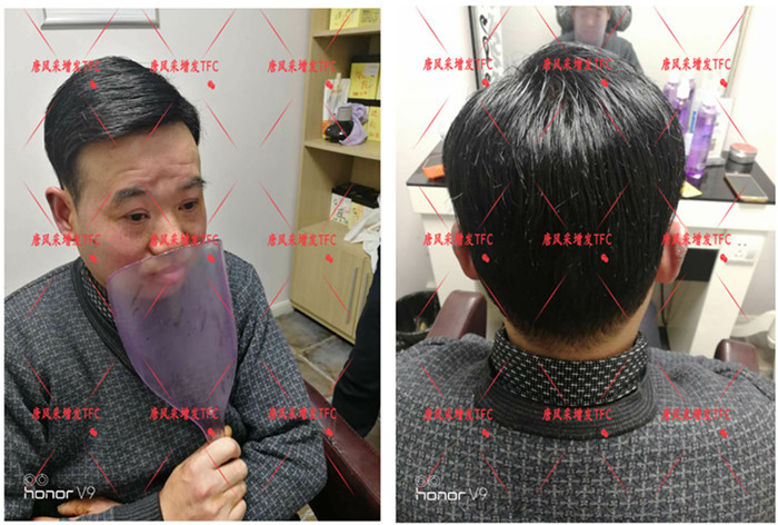 唐風采隱形增發客戶案例