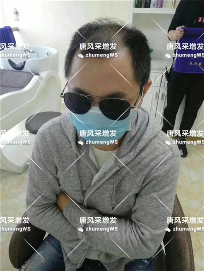 局部假發片 官方二維碼 唐風采客戶案例