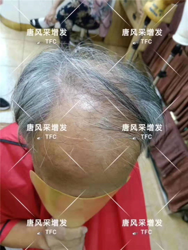 中老年人假發專賣店 唐風采客戶案例
