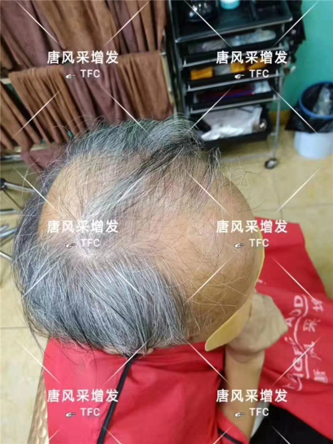中老年人假發專賣店 唐風采客戶案例