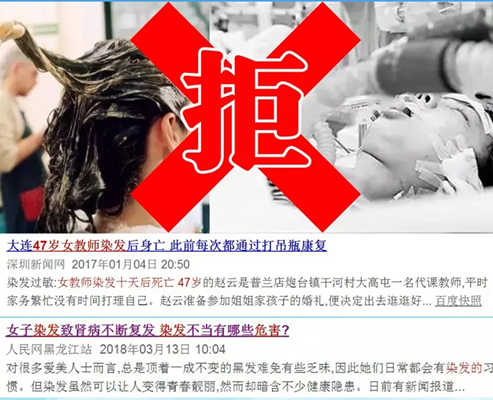 仿真假發專賣店 假發太差有哪些影響
