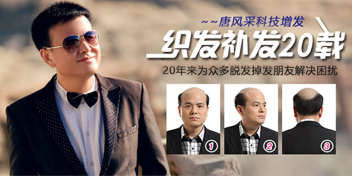 怎么快速增發 唐風采織發補發
