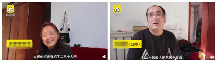 原因竟然是脫發
