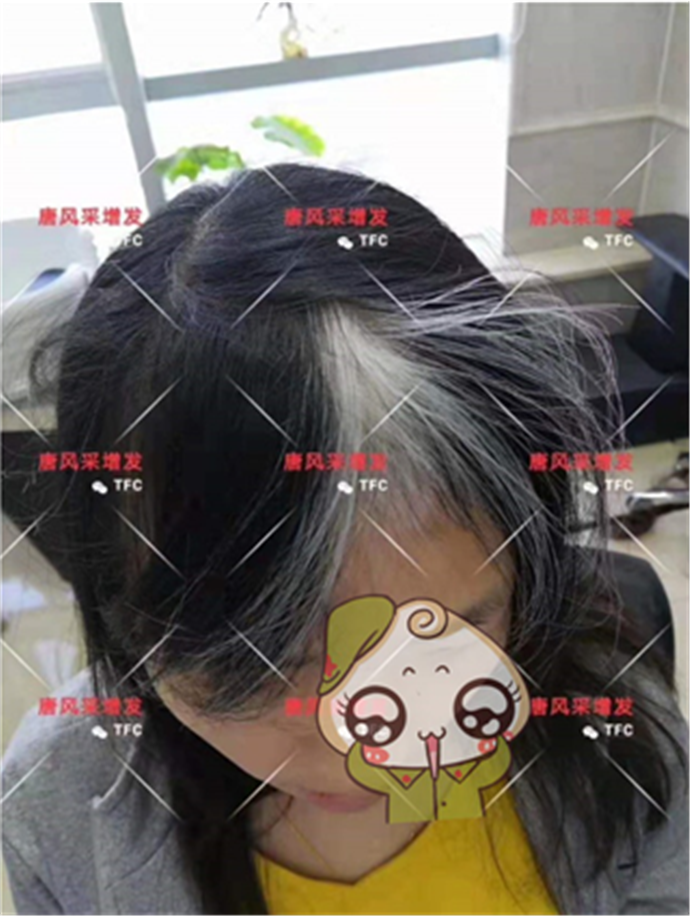女生假發專賣店 唐風采客戶增發前
