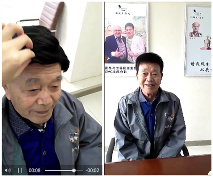 唐風采客戶戴假發前后對比