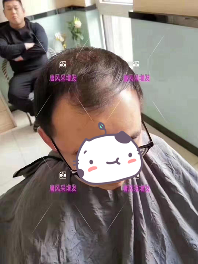 男士假發套 唐風采客戶增發前