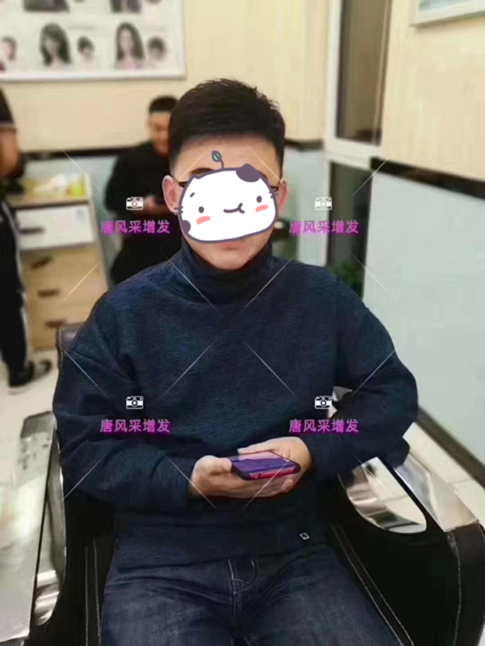 男士假發套發型 唐風采客戶增發后