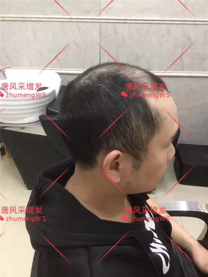 時尚個性假發(fā) 唐風采客戶增發(fā)前