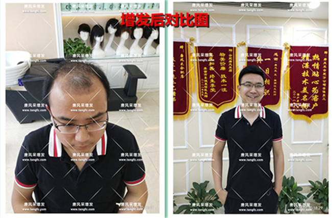 品牌真人假發 唐風采客戶案例