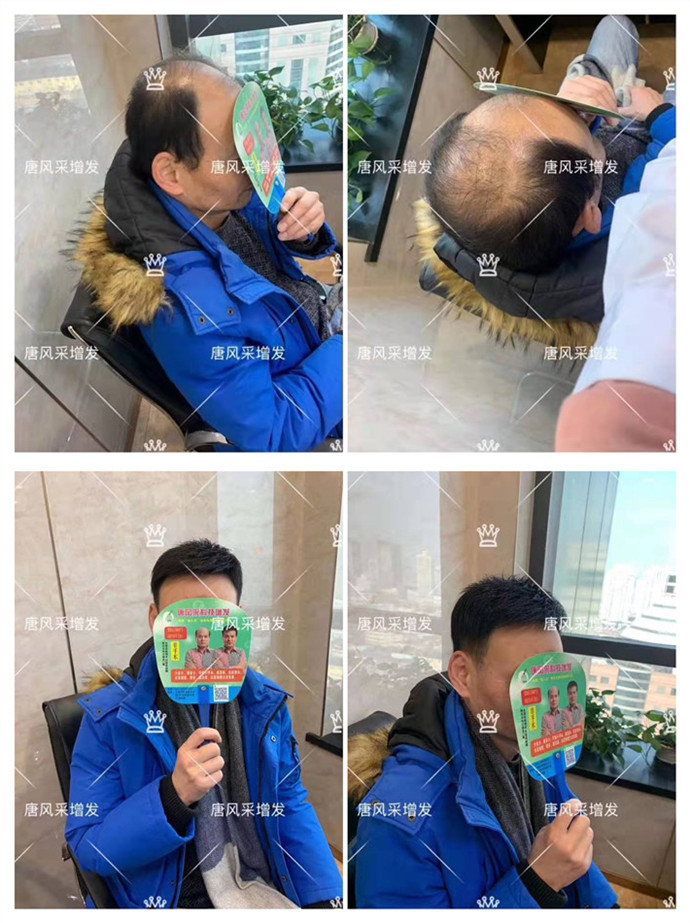 老人的假發套 唐風采客戶