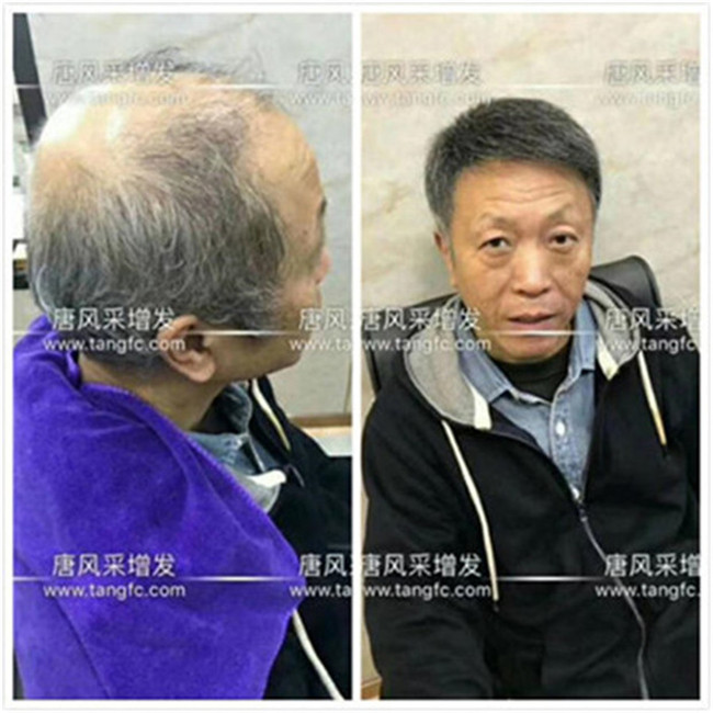 中老年男士真發假發 唐風采客戶自然真實的佩戴效果