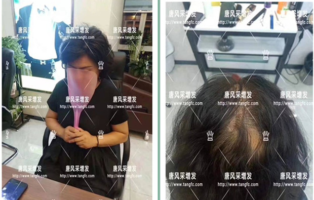 女生戴膠沾假發 唐風采客戶案例