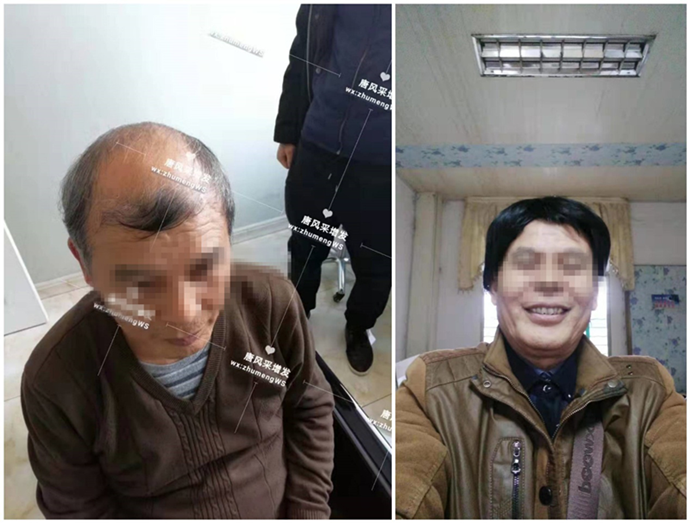男士假發發塊 \
