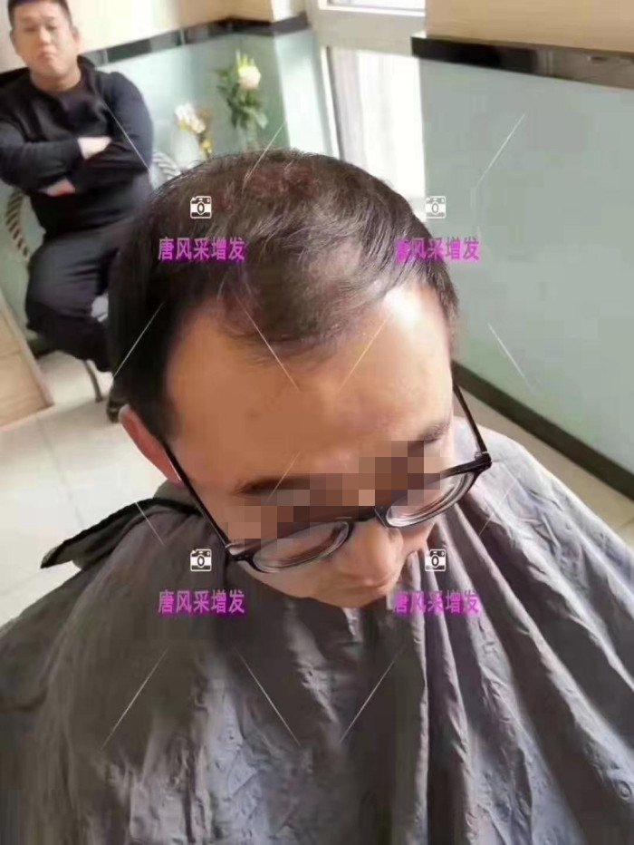 透氣假發品牌 \