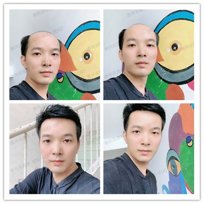 透氣假發品牌 \