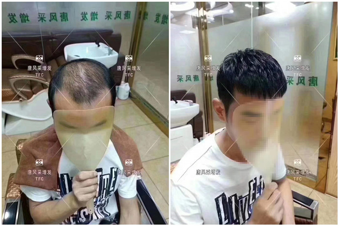 男士假發怎么打理 \