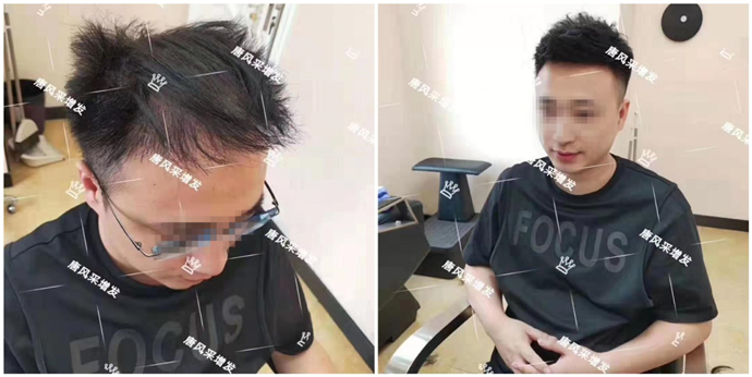 假發怎么打理自然 \