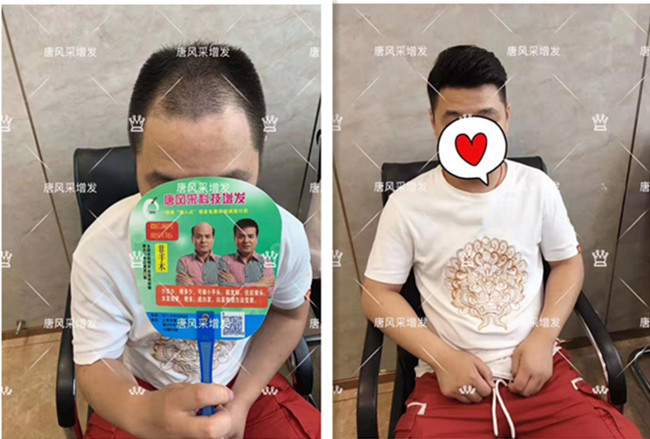 毛寸假發 \