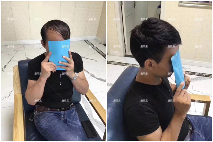 假發戴了會掉嗎 \