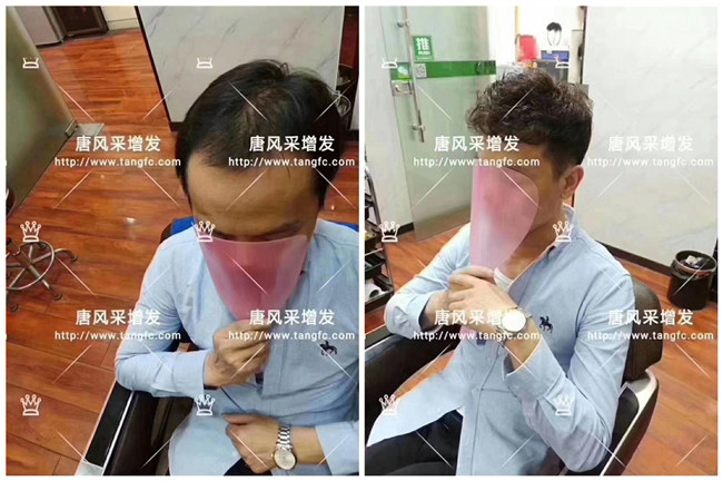 假發修剪 \