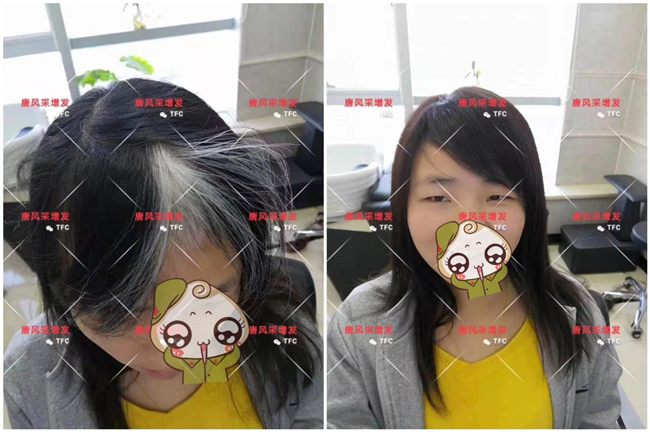 染發好還是戴假發好 \